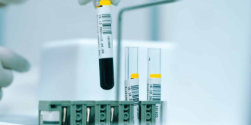 A Comprehensive Analysis of Health and Wellness Optimization at Regenics