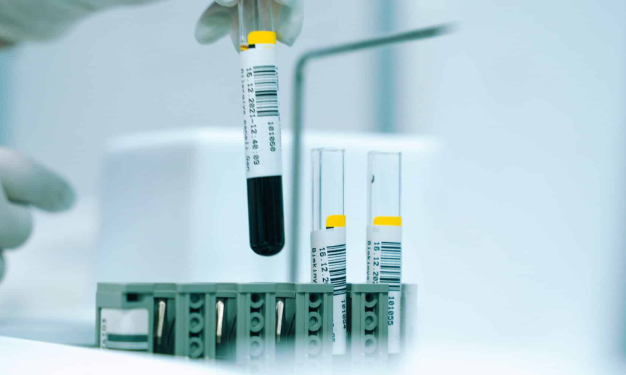 A Comprehensive Analysis of Health and Wellness Optimization at Regenics