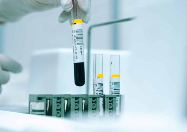 A Comprehensive Analysis of Health and Wellness Optimization at Regenics